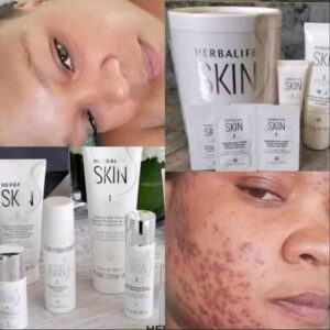 Skin Health Programs